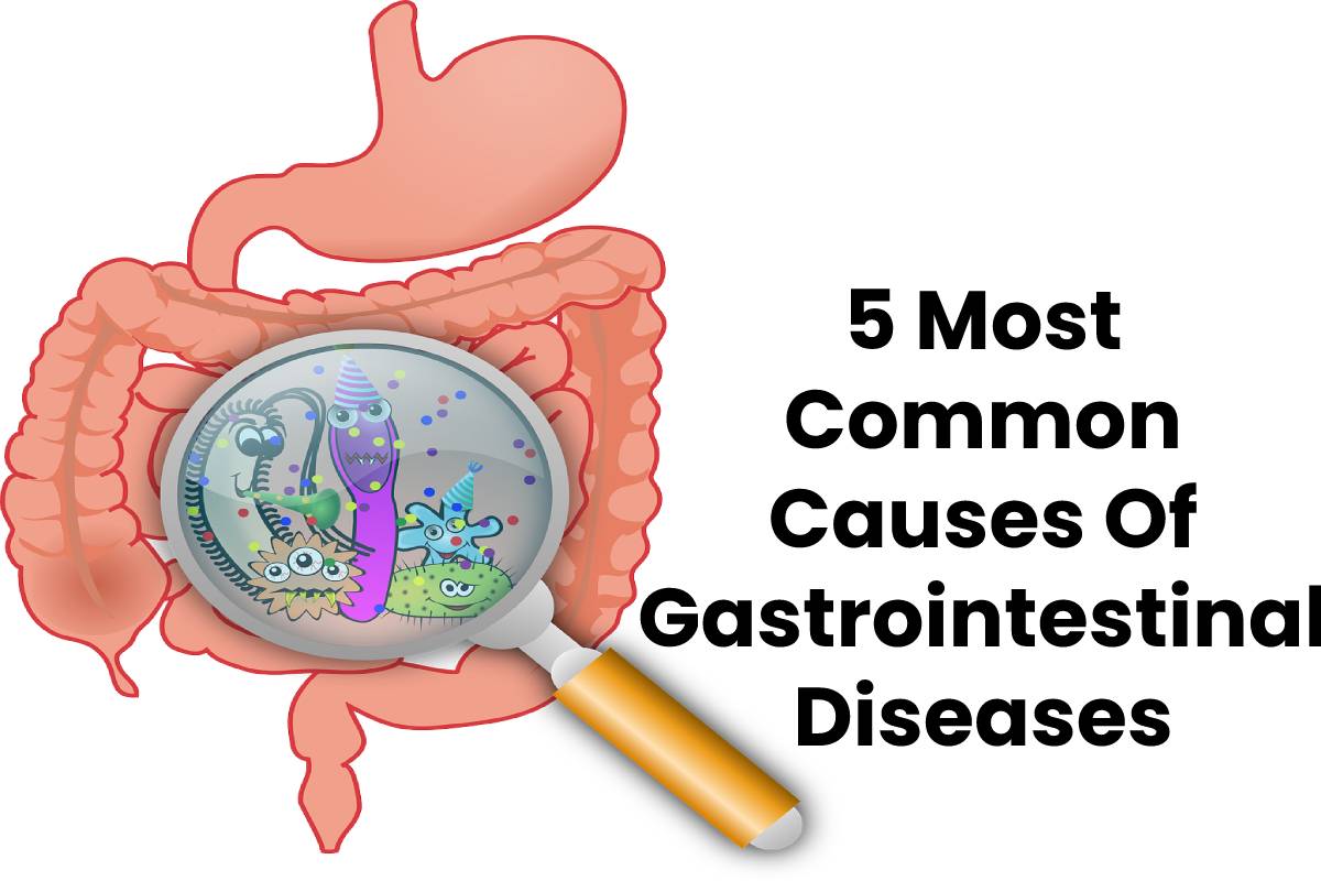 5 Most Common Causes Of Gastrointestinal Diseases Health Bloging