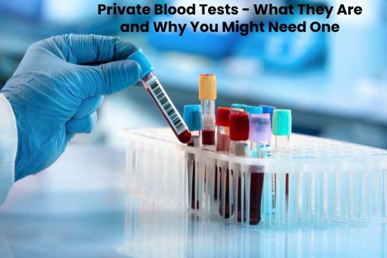 Private Blood Tests - What They Are and Why You Might Need One