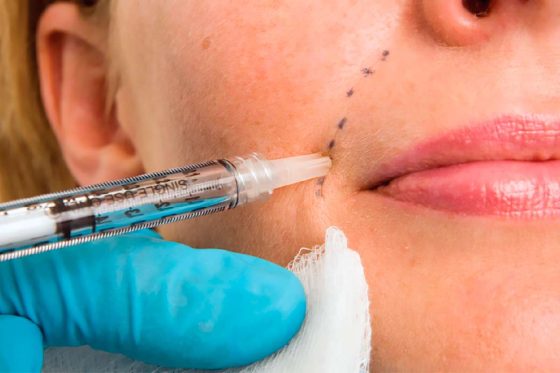 Facial Injectables and Fillers