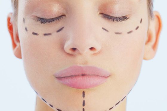 One-Stitch Facelift Vs Thread Lift