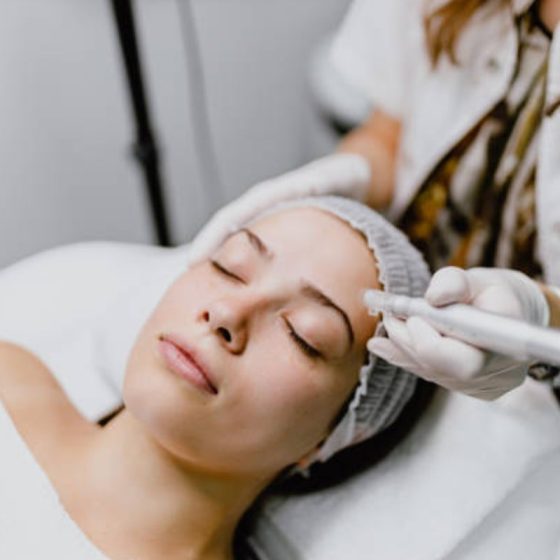 Microneedling